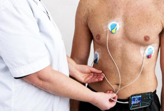 Holter Monitor